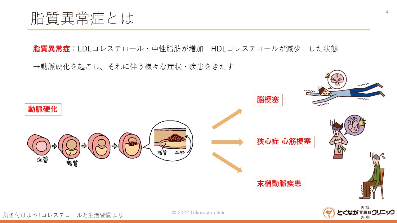 脂質異常症 - とくなが内科胃腸科外科クリニック | 熊本市 東区
